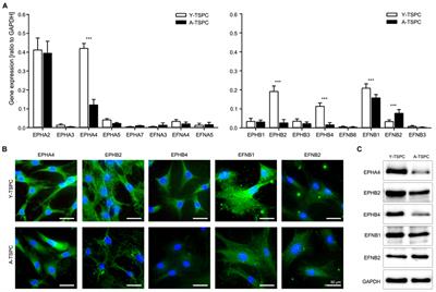 Activation of EphA4 and EphB2 Reverse Signaling Restores the Age-Associated Reduction of Self-Renewal, Migration, and Actin Turnover in Human Tendon Stem/Progenitor Cells